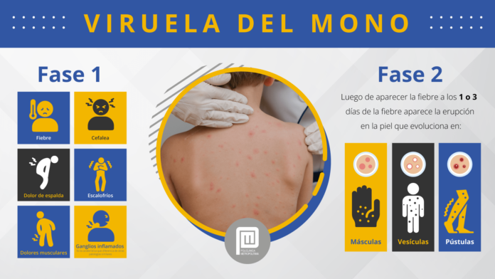 Viruela del mono en América Latina: Argentina, Colombia y El Salvador anuncian medidas de protección